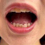 Thumbnail of related posts 105